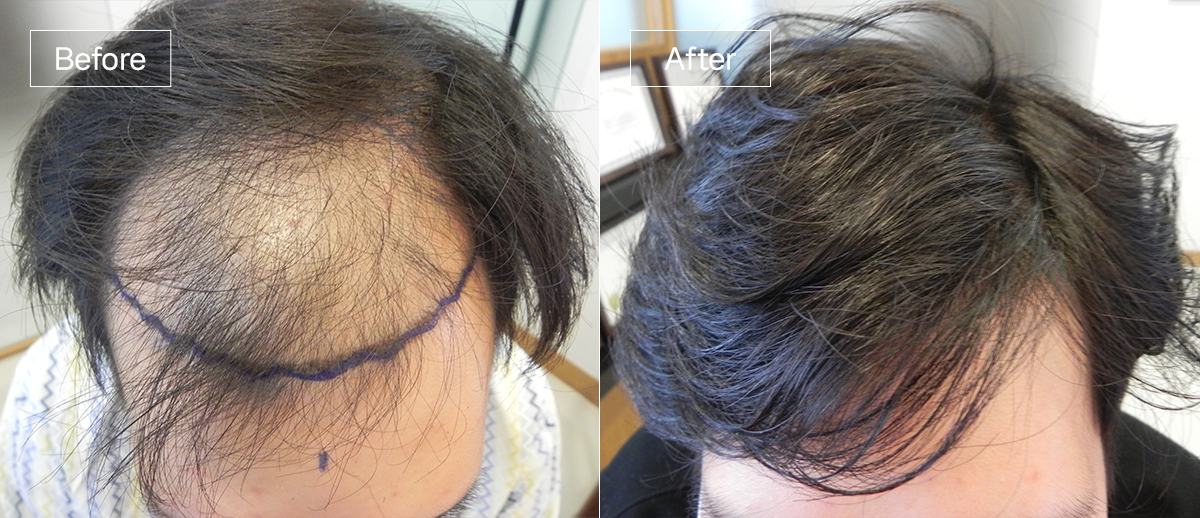 /filedata/md_board/20251229125817_MoVeFrsc_sub1_slide2.jpg 전후사진