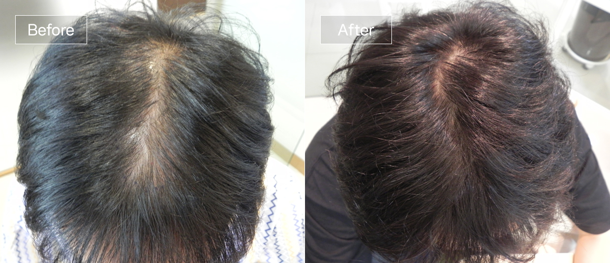 /filedata/md_board/20251229125837_WFN7yUZk_sub1_slide5.jpg 전후사진