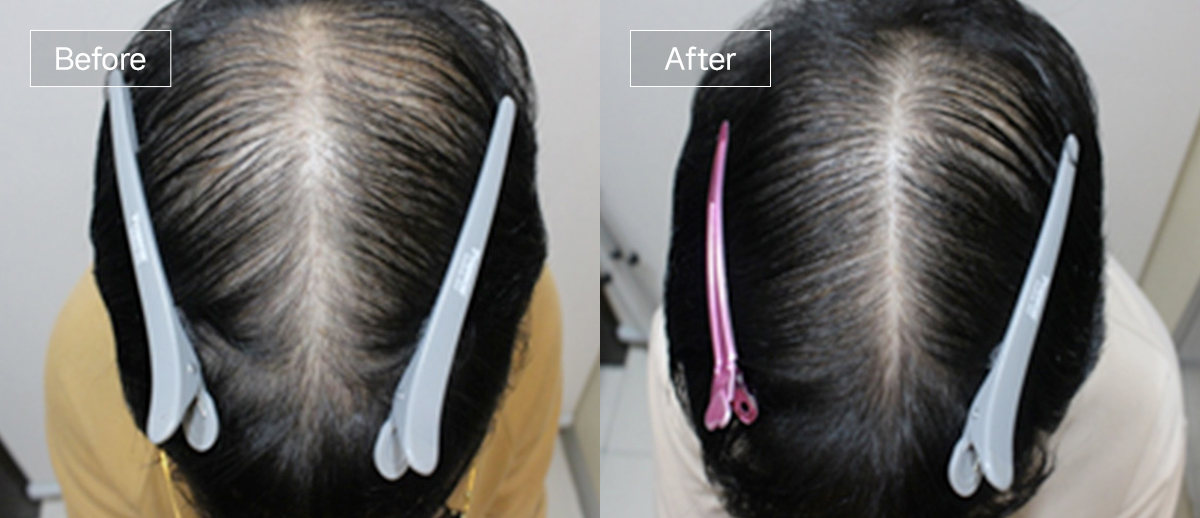 /filedata/md_board/20260102170117_nxyw2QId_sub4_slide9.jpg 전후사진