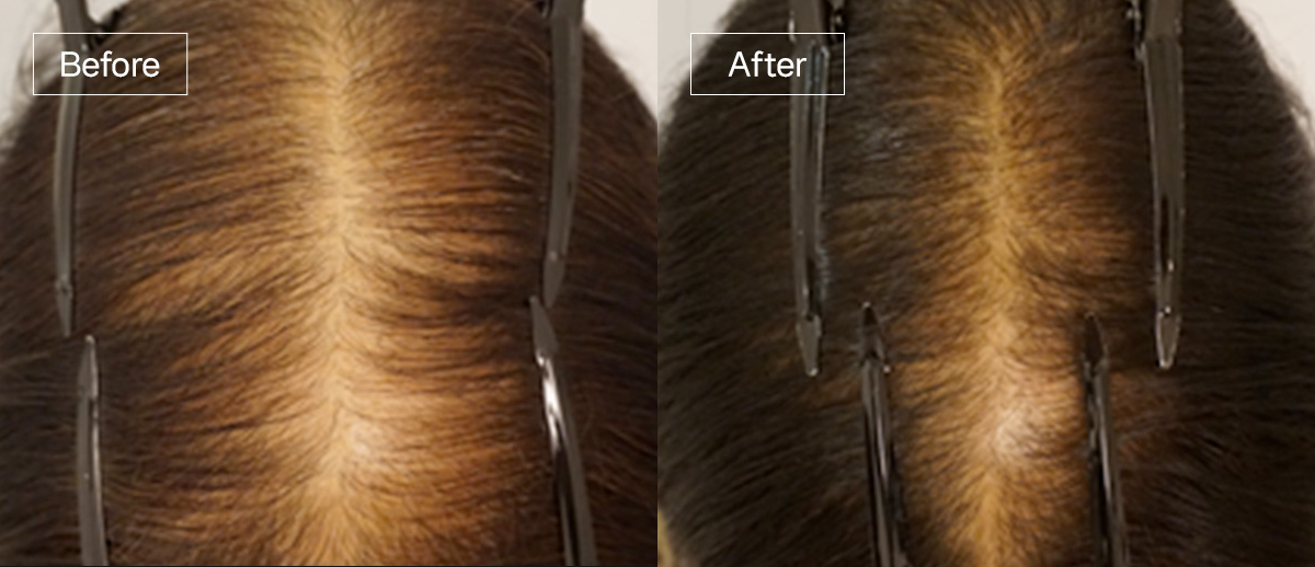 /filedata/md_board/20260102170145_zMCs0tGP_sub4_slide7.jpg 전후사진