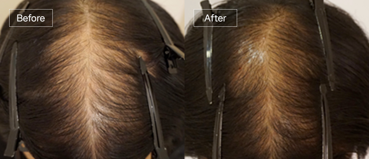 /filedata/md_board/20260102170155_xaBQzRIP_sub4_slide6.jpg 전후사진