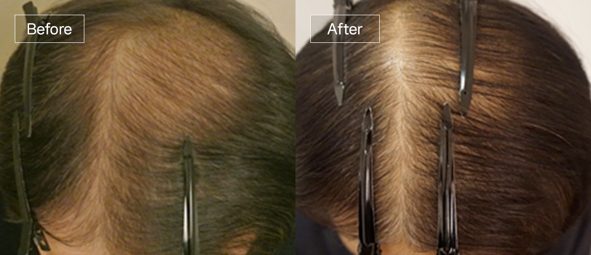 /filedata/md_board/20260102170205_WpzQRhqt_sub4_slide5.jpg 전후사진