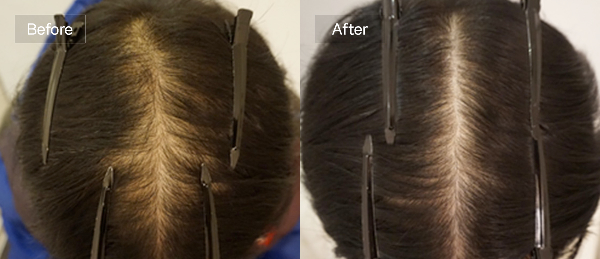 /filedata/md_board/20260102170213_t7SLdxYv_sub4_slide4.jpg 전후사진