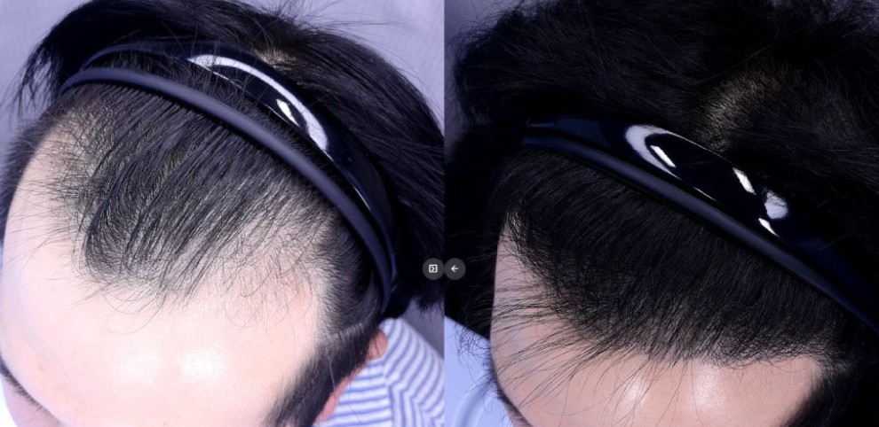 /filedata/md_board/20260212141334_2DbWfZaC_1.jpg 전후사진