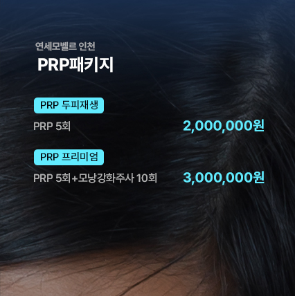 연세모벨르 이벤트