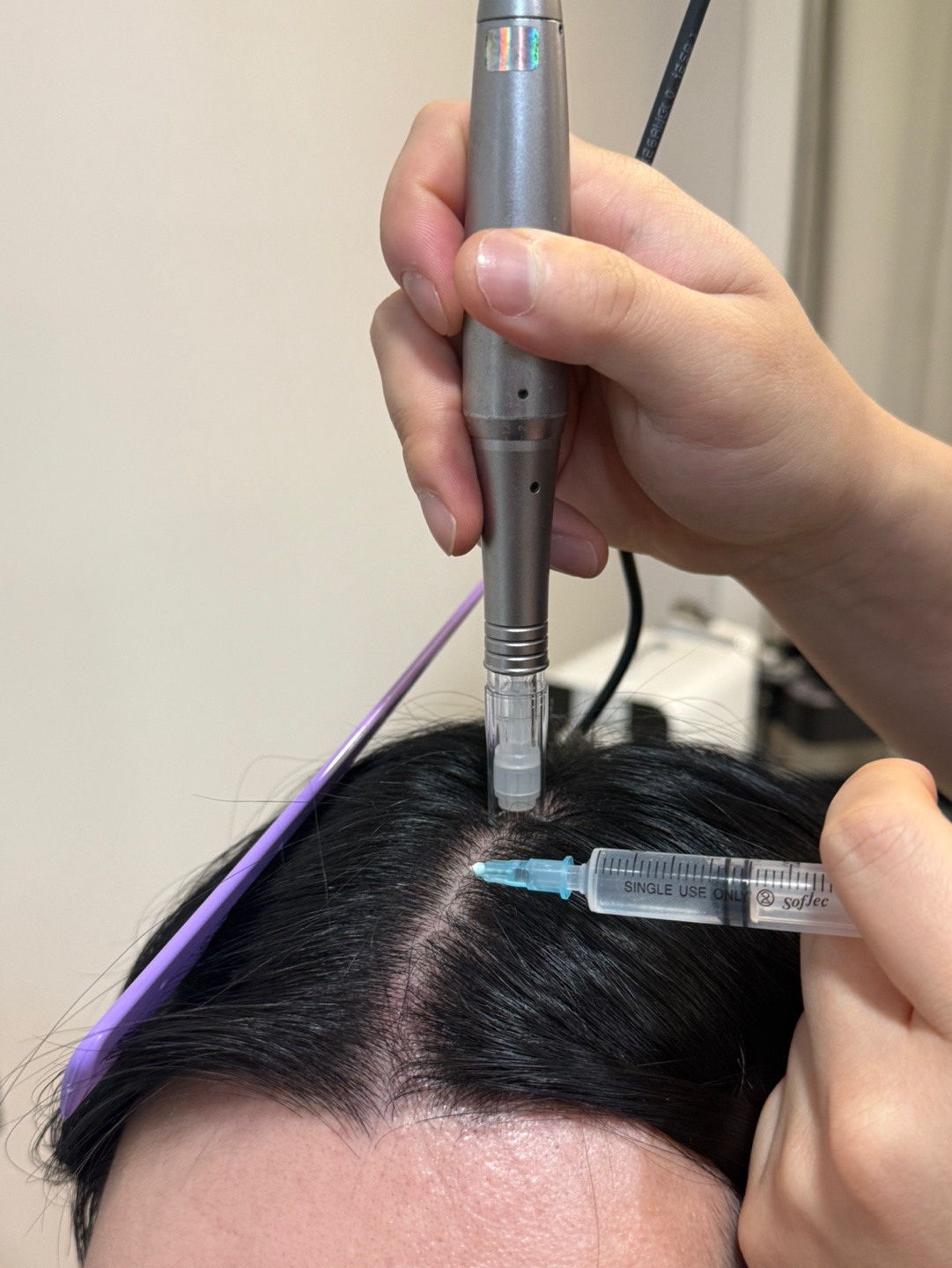 scalp