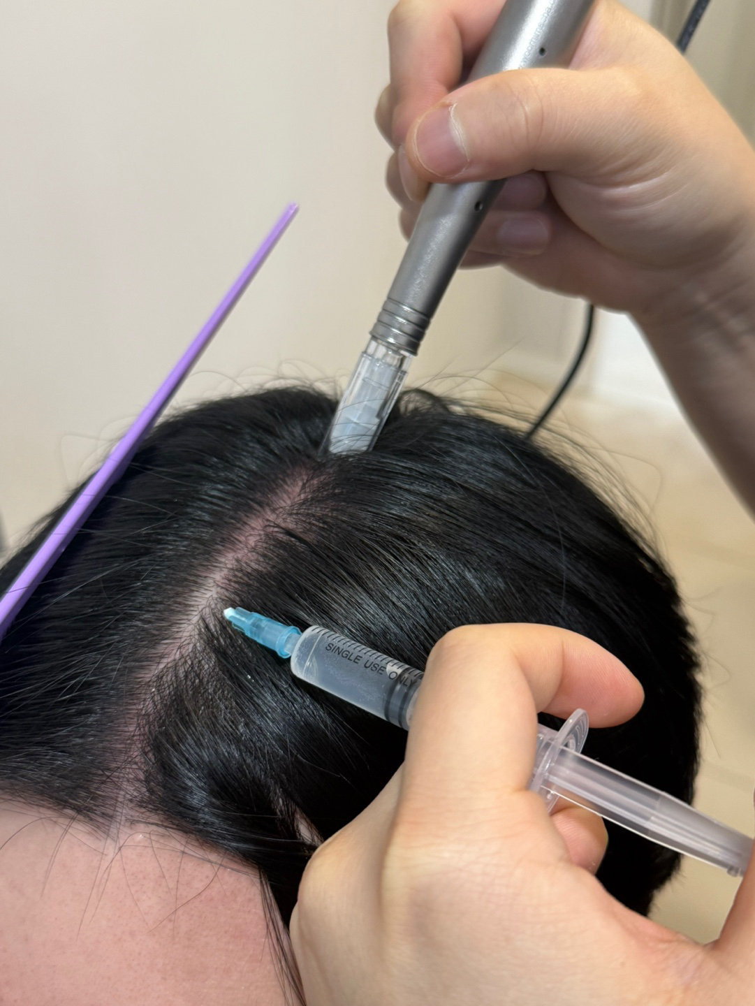 scalp